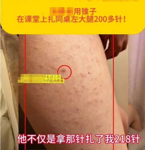 校園防欺凌報警器：“女生被同桌扎218針”，未達到校園霸凌標準？多方回應